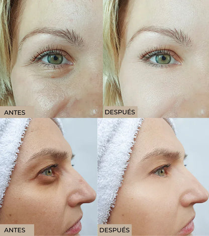 Celyn™ Reafirmante Facial Instantâneo
