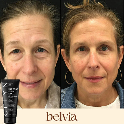 Celyn™ Reafirmante Facial Instantâneo