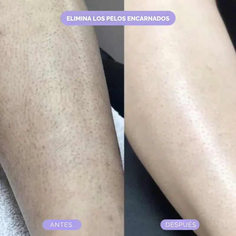 Bleame™ Crystal Eliminador de Vello