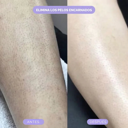 Bleame™ Crystal Eliminador de Vello
