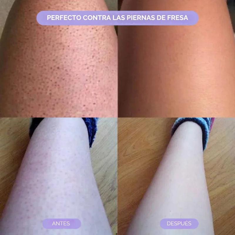 Bleame™ Crystal Eliminador de Vello