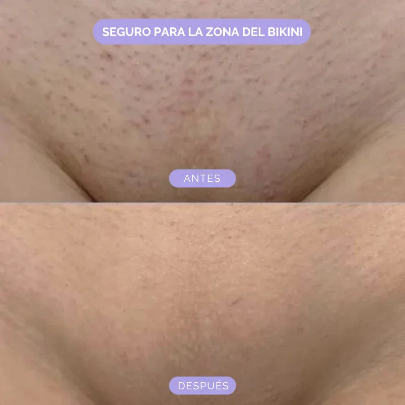 Bleame™ Crystal Eliminador de Vello