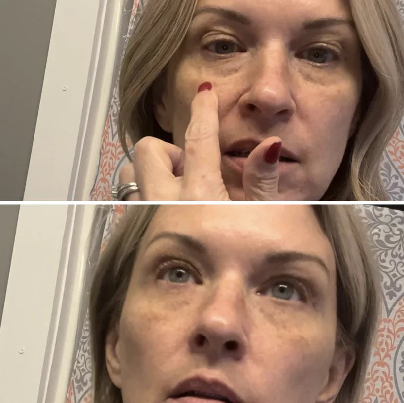 Celyn™ Reafirmante Facial Instantâneo
