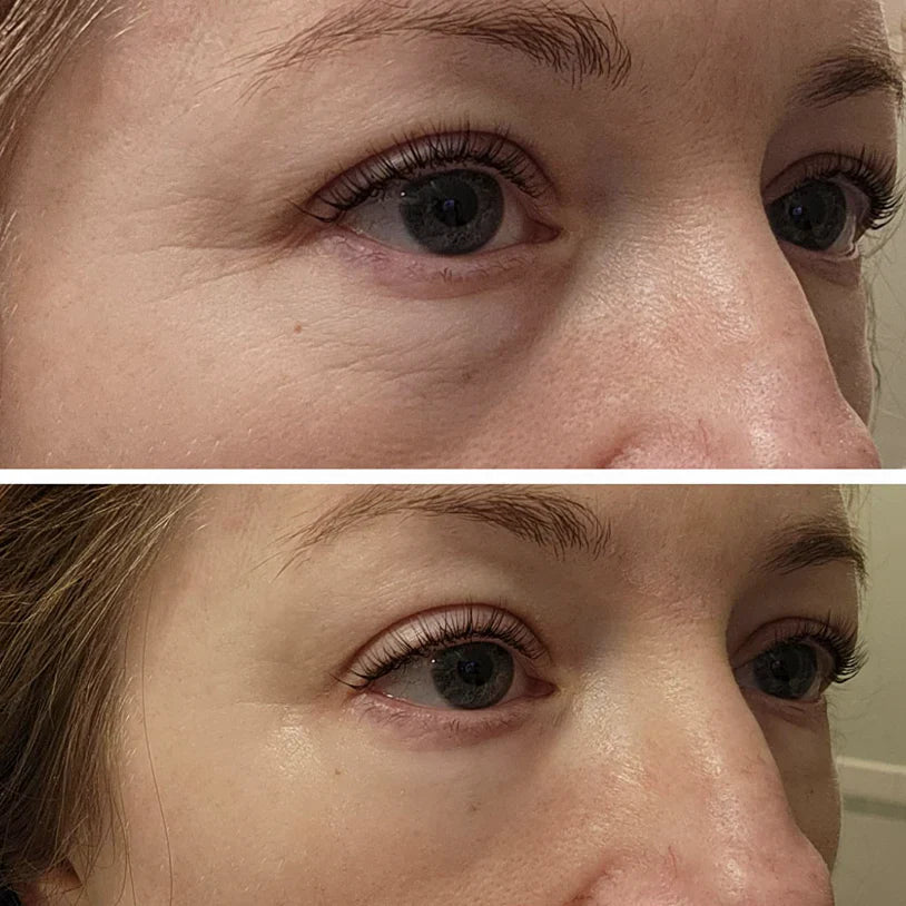 Celyn™ Reafirmante Facial Instantâneo