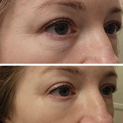 Celyn™ Reafirmante Facial Instantâneo