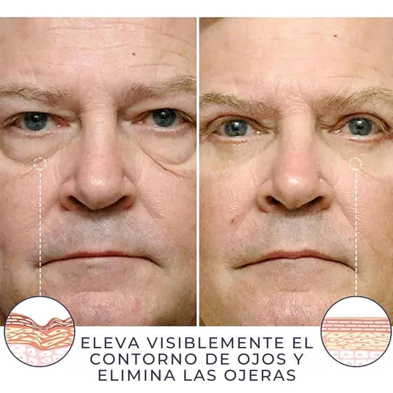 Celyn™ Reafirmante Facial Instantâneo